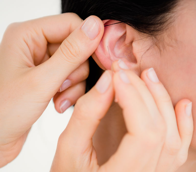 ear acupuncture in london