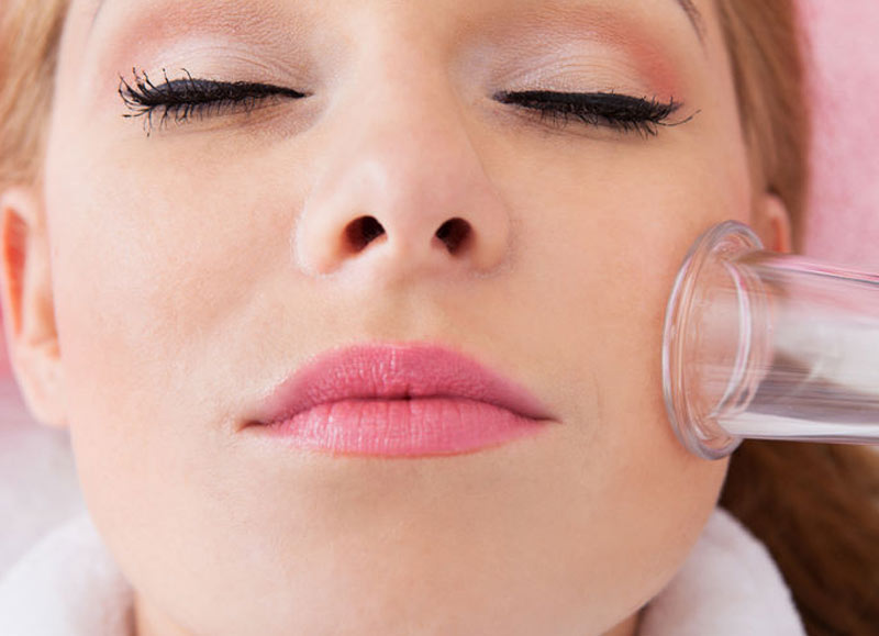 facial cupping treatment london